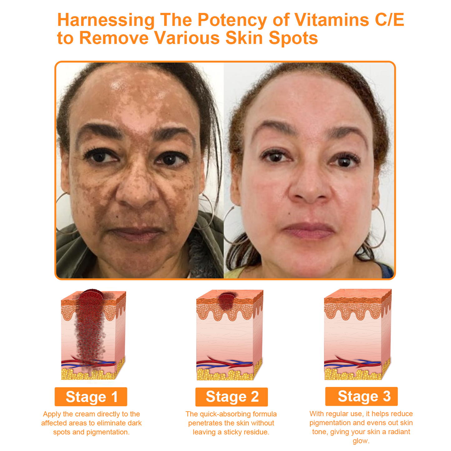 BBOJI™ 7-Day Multi-Effect All-in-One Skincare Cream (👨⚕️AAD Recommended)