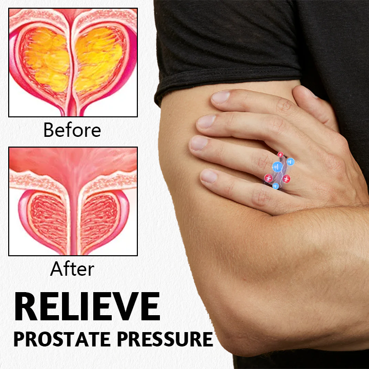 (🔥LAST DAY SALE-80% OFF🔥) Miniyou™ Prosta Magnetic Harmony Ring
